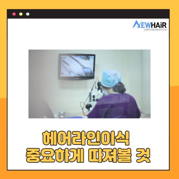 비절개 헤어라인이식으로 볼륨감있는 이마를 관련 이미지 3