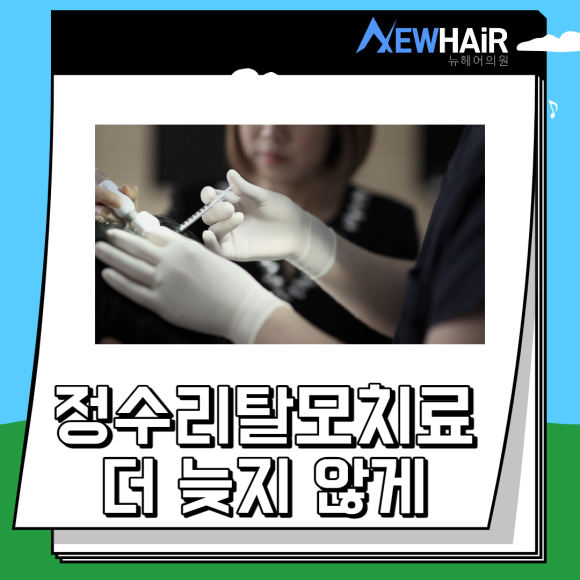 정수리탈모치료 더 늦지 않게 관련 이미지 1