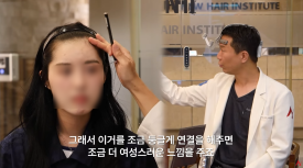 Improving an M-Shaped Hairline: Which Hairline Looks Natural? image 2