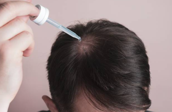 Clascoterone Hair Loss Treatment (A New Topical Hair Loss Drug): How Is It Different from Existing Medications? image 1