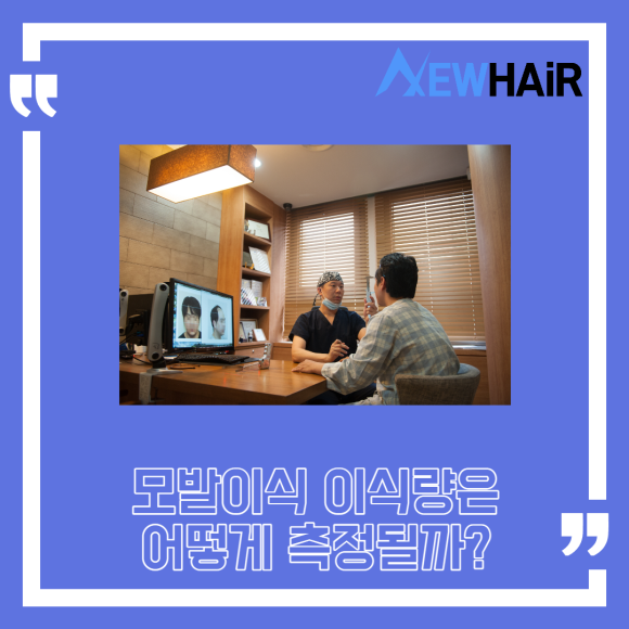 서울 모발이식 고밀도모발이식은? 관련 이미지 3