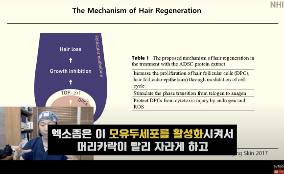 탈모치료 엑소좀, 엑소좀 뜻, 역할, 탈모 치료 효과ㅣ 정수리 탈모 ㅣ 전후사진 관련 이미지 10