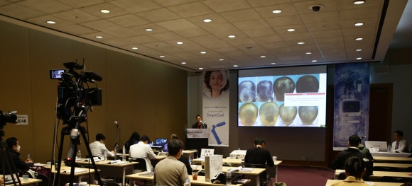 2023년 10월 11월 학술활동 정리: 보툴리눔 톡신 탈모치료 및 바르는 피나스테리드 발표 [코아트,휴온스 심포지엄] 관련 이미지 3