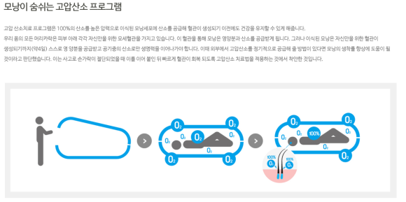모발이식 수술 뉴헤어에서 알아보기(절개,비절개,헤어라인,모발이식방법,수술) 관련 이미지 26
