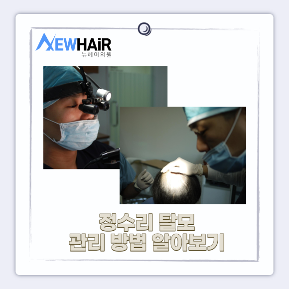 정수리탈모 관리 방법 알아보기 관련 이미지 1