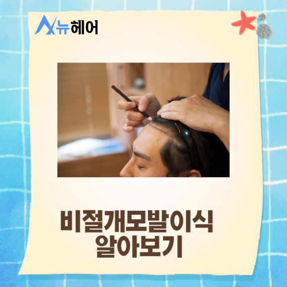 비절개모발이식 비용도 따져보고 관련 이미지 2