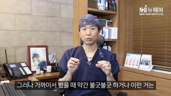 헤어라인교정(모발이식) 붉은 기... 언제 없어질까? 관련 이미지 5