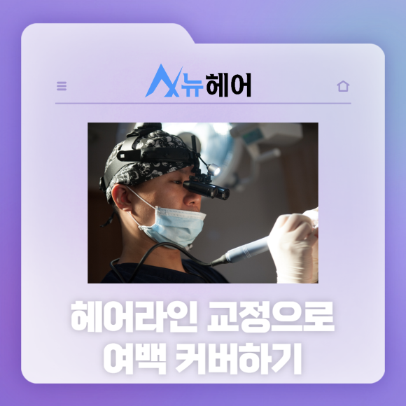 헤어라인교정수술 티 나지 않는 풍성함 관련 이미지 2