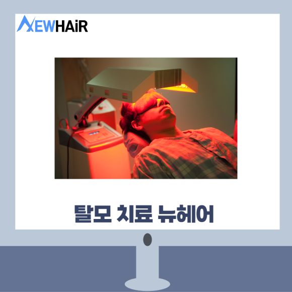 탈모검사비용 제대로 알고 치료하자 관련 이미지 9