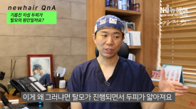 Can Oily Scalp Cause Hair Loss? What’s the Truth? image 5