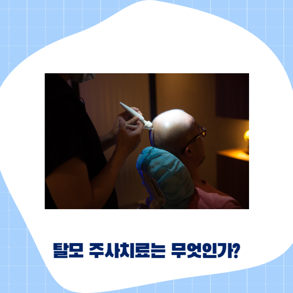 여자가르마탈모 치료방법을 확실히 알고 관련 이미지 3