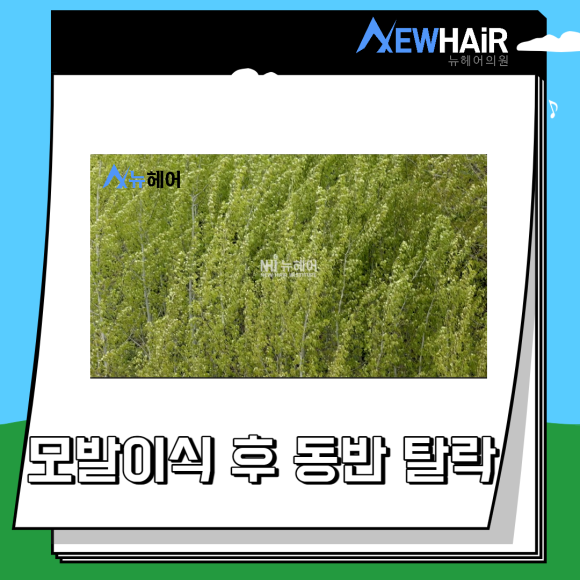 절개 모발이식 수술 총정리 관련 이미지 7