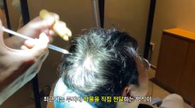 What Are the Effects and Side Effects of Follicular Injections? image 2