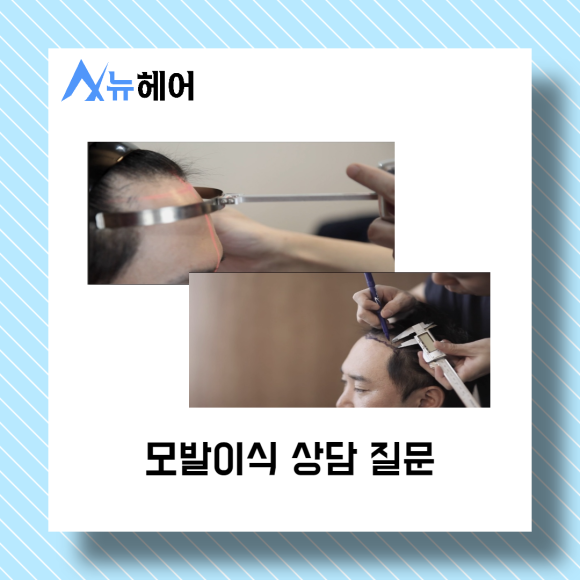 강남역 모발이식 상담 필수 질문은? 관련 이미지 2