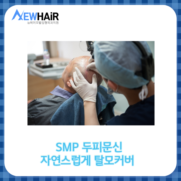 SMP 두피문신 자연스럽게 탈모커버 관련 이미지 1