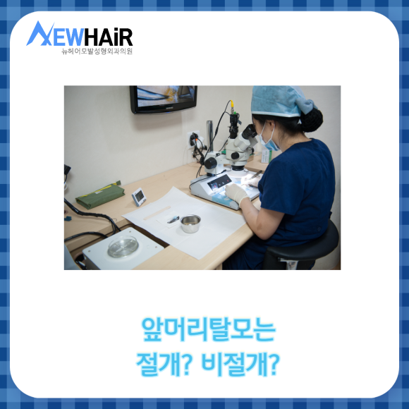 남자 앞머리탈모 정확한 치료방법은? 관련 이미지 4