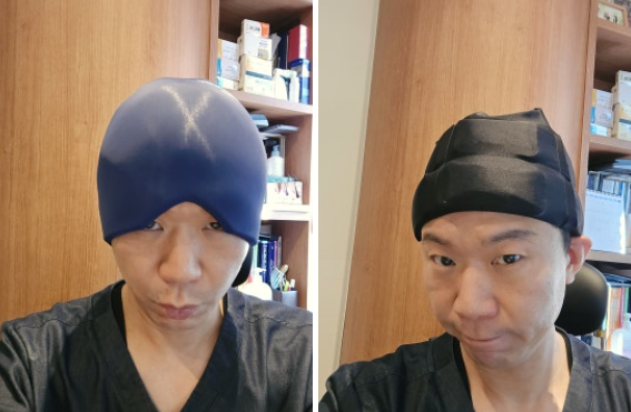 Chemotherapy-Induced Hair Loss: What If It Continues Even After Treatment Ends? Management and Prevention image 2