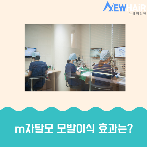m자탈모 해결은 모발이식 관련 이미지 3