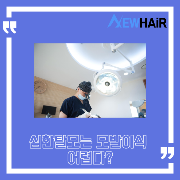서울 모발이식 고밀도모발이식은? 관련 이미지 5