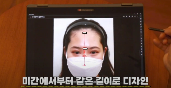 얼굴형에 따라 달라지는 모발이식 헤어라인, 황금비율이 있을까? 관련 이미지 3