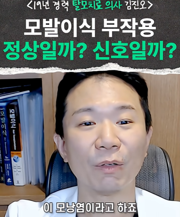 19년차 의사가 답하는 모발이식 부작용 FAQ(쉐딩, 모낭염, 괴사) 관련 이미지 3