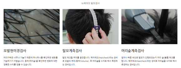 모발이식 나이 알아보고 결정해요 관련 이미지 22