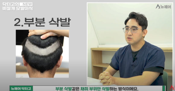 랜던 도노반의 사례로 본 모발이식 안전 영역과 채취 부위(비절개) 관련 이미지 6