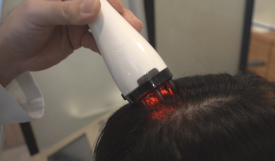 Hair Loss Care: Can It Help a Sensitive Scalp? image 8