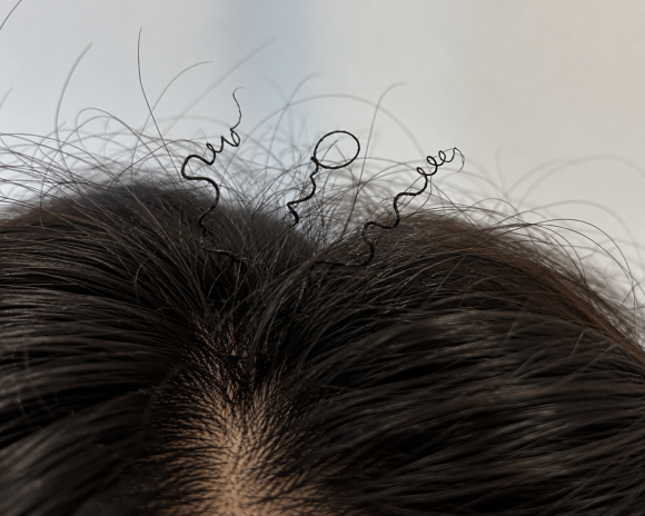 Why Do Coarse, Curly Hairs Grow on the Head? Is It Normal? Causes and Care image 1