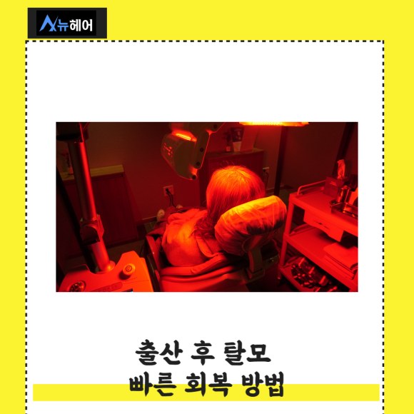 출산 여성탈모 빠른 회복방법은? 관련 이미지 5