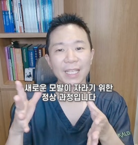 모발이식 후 머리 빠짐, 생착 실패일까? 암흑기·밀도·붉은기 관련 이미지 6