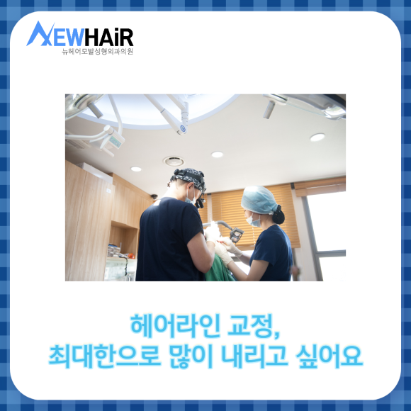 헤어라인교정 자연스럽게 하려면 관련 이미지 3