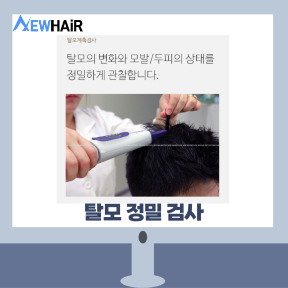 탈모검사비용 제대로 알고 치료하자 관련 이미지 3