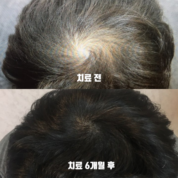 [뉴헤어] 관련 이미지 3