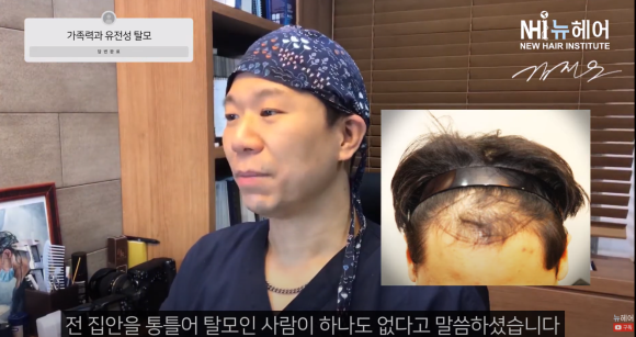 가족력 없는데... 탈모일까? ㅣ 유전성탈모 관련 이미지 4