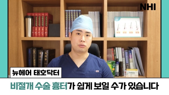 모발이식, 쌍가마에도 가능할까? ㅣ모발이식 제비추리 관련 이미지 10