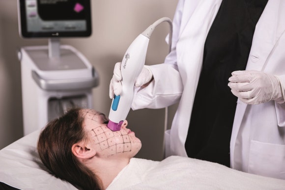 Thermage Is Good for Fine Wrinkles — Why Thermage FLX Is So Popular at Just Plastic Surgery! image 1
