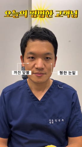 What Is Ozempic Face? Just Plastic Surgery Presents Solutions! image 9