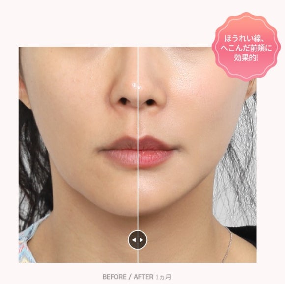 # The Reason Many Japanese Customers Visit JUST Plastic Surgery image 1