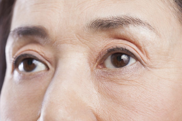 Brow Lift: Just Plastic Surgery Reveals the Secret to Great Results! image 1