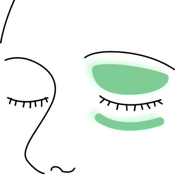 Thermage Is Good for Fine Wrinkles — Why Thermage FLX Is So Popular at Just Plastic Surgery! image 8