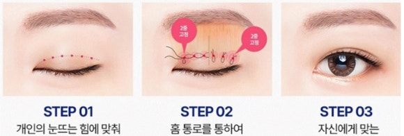자연유착 눈매교정 안 되는 눈 5가지 - 이것만 보면 자연유착 가능한 눈의 기준 정확히 알 수 있어요! 관련 이미지 9