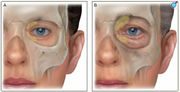 Do Signs of Aging in Appearance Accelerate Sharply in Your 40s and 50s? — JUST’s Solution image 4
