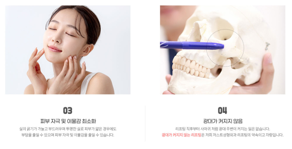Thread Lifting: Why It Should Be Performed by a Plastic Surgery Specialist image 2