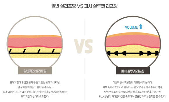 Midface Lifting: Start with Peach Silhouette Lifting at Just. image 9