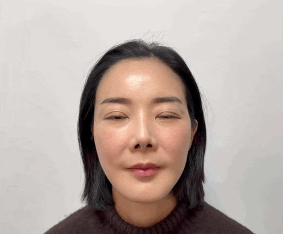 눈꼬리 리프팅, 고양이상이 되고 싶으면 이 글을 보세요! 관련 이미지 11