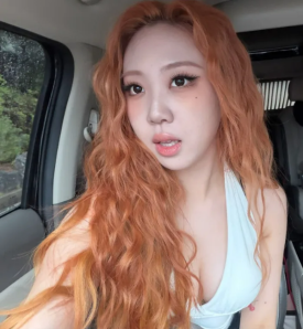 눈밑 수술, 이제는 국민 성형수술이 되다? (눈밑지방재배치와 하안검의 차이) 관련 이미지 6