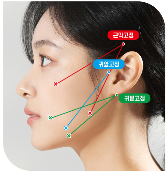 트리플 에그가 특별한 이유 ✨ 관련 이미지 1