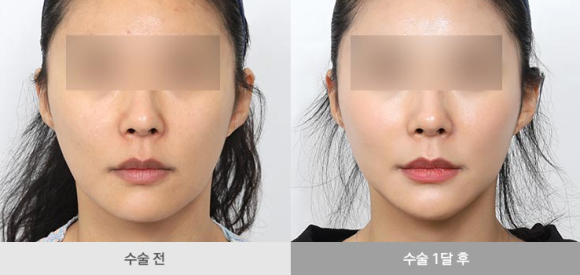Silhouette Soft: If You Haven’t Tried It Yet, You Can Skip This Post. image 8