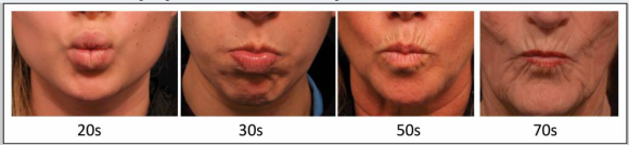 Do Signs of Aging in Appearance Accelerate Sharply in Your 40s and 50s? — JUST’s Solution image 3